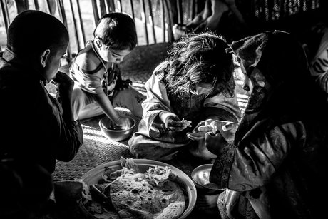 2000 کودک در خراسان‌شمالی با سوء تغذیه مواجه‌اند
